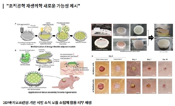 부산대 연구팀, 바이오프린팅 활용 지방조직 피부 재생효과 입증  대표이미지