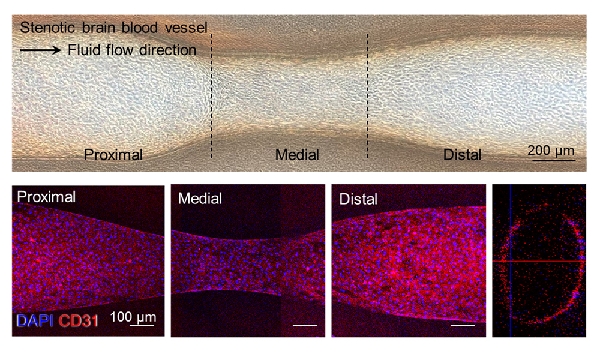 [PNU 리서치]김병수 교수팀, 3D 바이오프린팅으로 실험용 뇌혈관 만든다 대표이미지