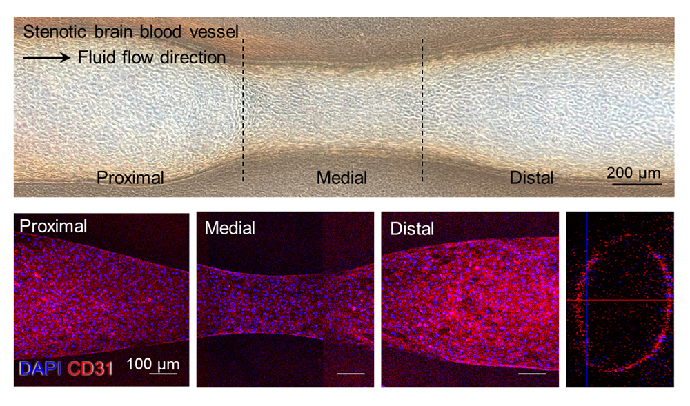 [PNU 리서치]김병수 교수팀, 3D 바이오프린팅으로 실험용 뇌혈관 만든다
